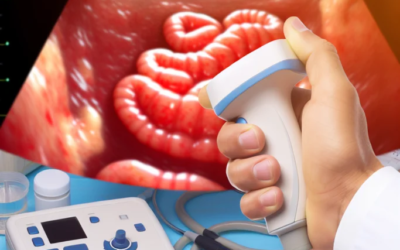 Revolutionary Intestinal Ultrasound Technology Offers New Hope for IBD Monitoring and Care