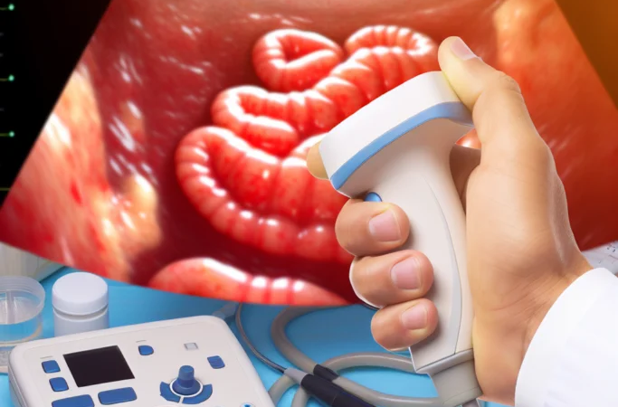 Revolutionary Intestinal Ultrasound Technology Offers New Hope for IBD Monitoring and Care