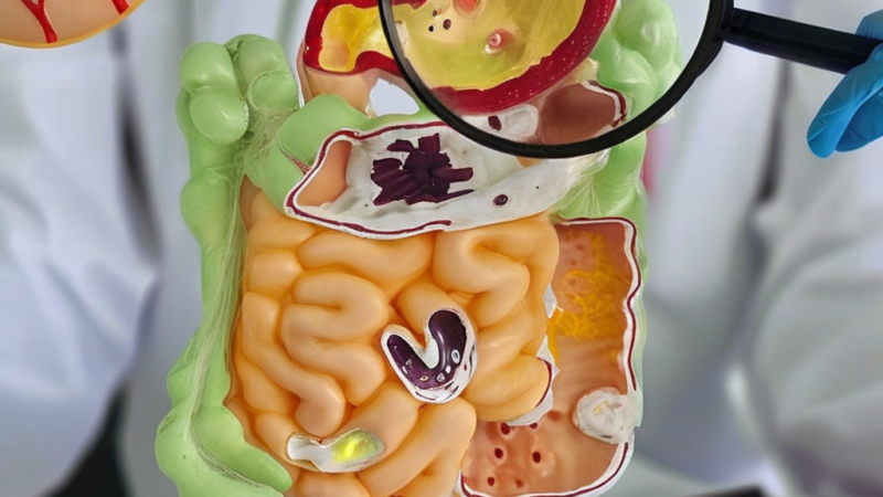 Global IBD Cases Surge: What New Research Means for Your Health Journey