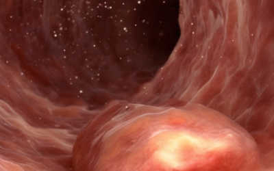 Barnacle-Inspired "Living Glue" Shows Promise for Healing IBD Gut Wounds