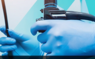 AI-Powered Endoscopic Scoring: A Revolutionary Step Forward for Ulcerative Colitis Care