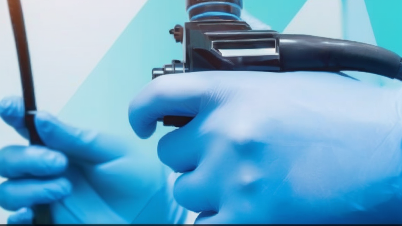 AI-Powered Endoscopic Scoring: A Revolutionary Step Forward for Ulcerative Colitis Care