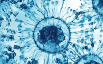 New Research Links Thiopurines to Increased Mild Infections in IBD Patients